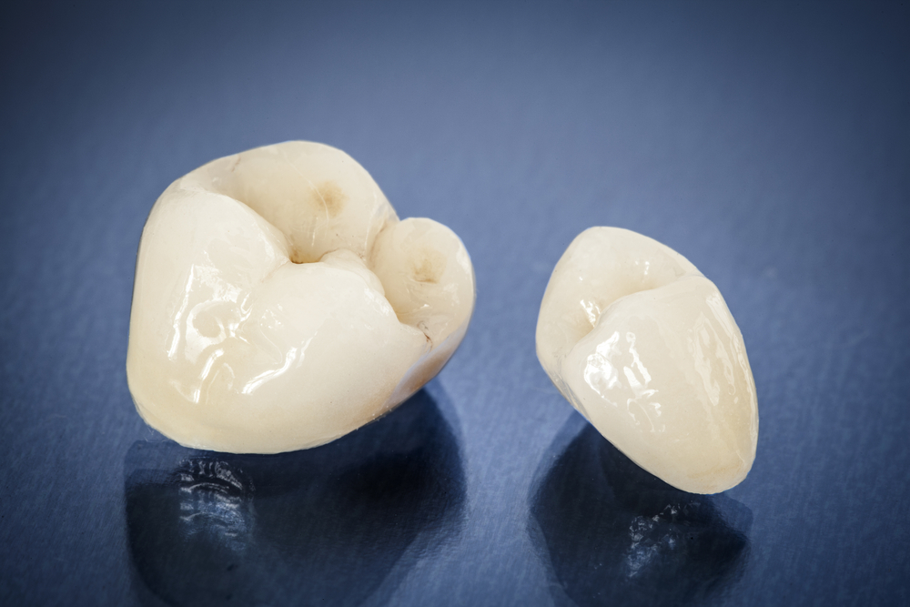 Gum Restoration