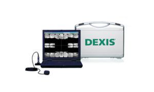Dexis Digital X Ray - Oakland, CA - TDL Dental Group